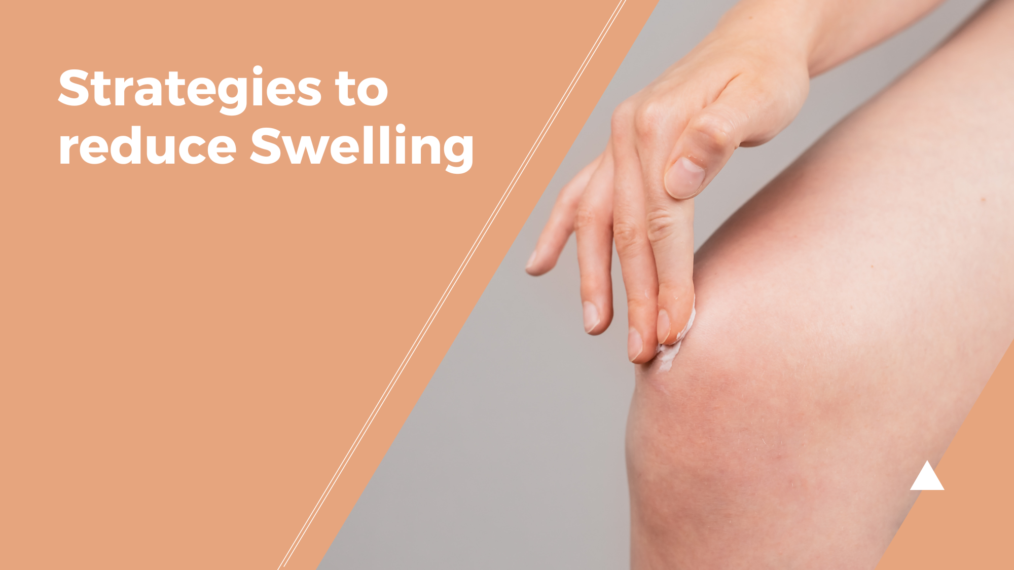 Strategies to Reduce Swelling